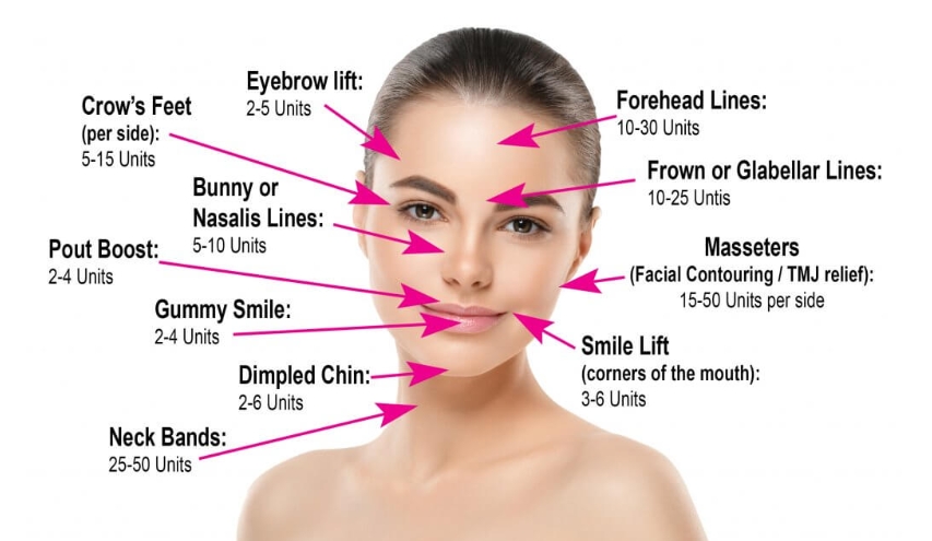 Where Can i Get Botulinum Toxin